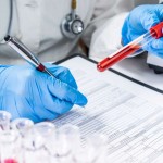 HIV Tests